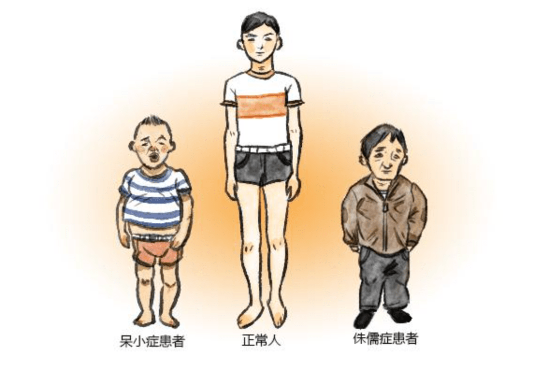 151660533738944504.jpeg 青少年缺碘.jpeg