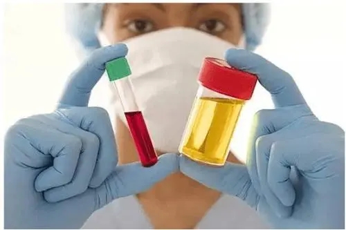 血碘檢測(cè)與尿碘檢測(cè)該選擇哪個(gè)