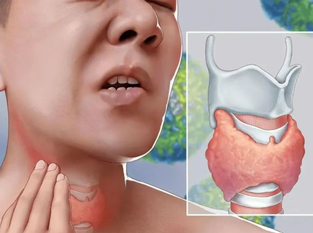 121710232801124211.png 屏幕截圖 2024-03-12 163902.png